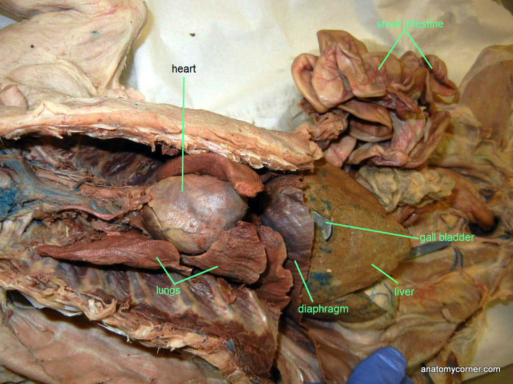 Dissection WARNING CLICK AT YOUR OWN RISK - Sean Nickels ... gall bladder body diagram 
